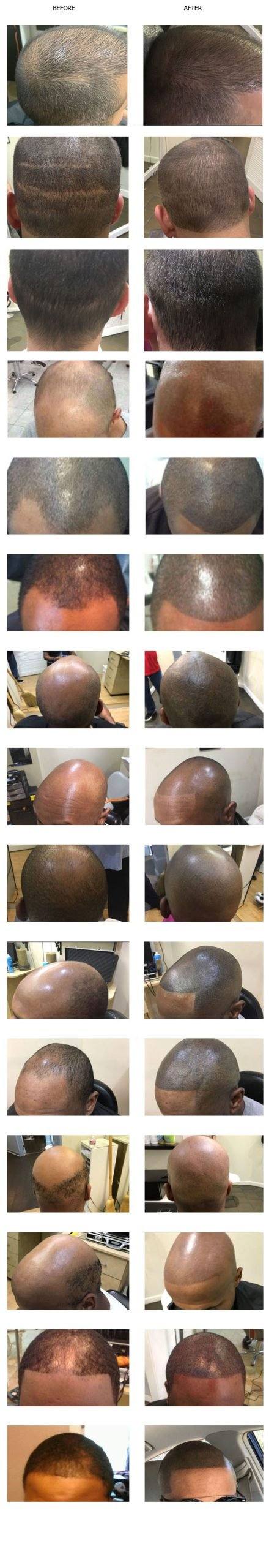 Men SMP Gallery – The Hair Simulation Company: final SMPMENSto