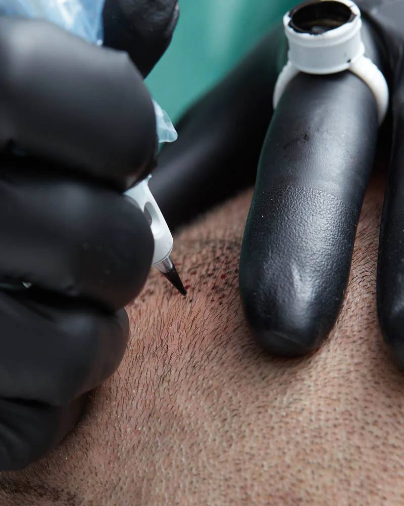 SMP Training Class – The Hair Simulation Company: scalp micropigmentation training course 800x