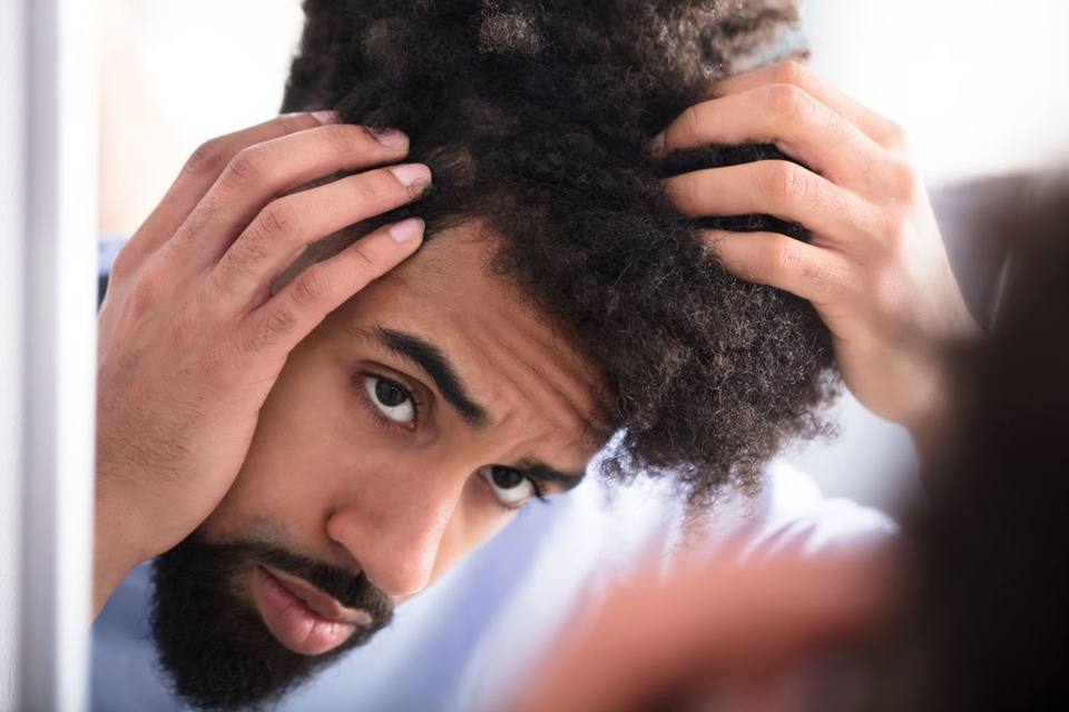Scalp Micropigmentation for Men in Atlanta – The Hair Simulation Company: smp men img1